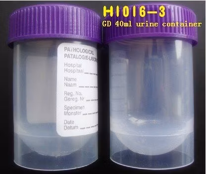 40ml Specimen Container /Urine Container Conical Bottom